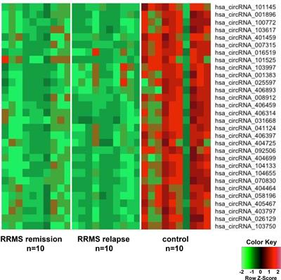 Impact of Diminished Expression of circRNA on Multiple Sclerosis Pathomechanisms